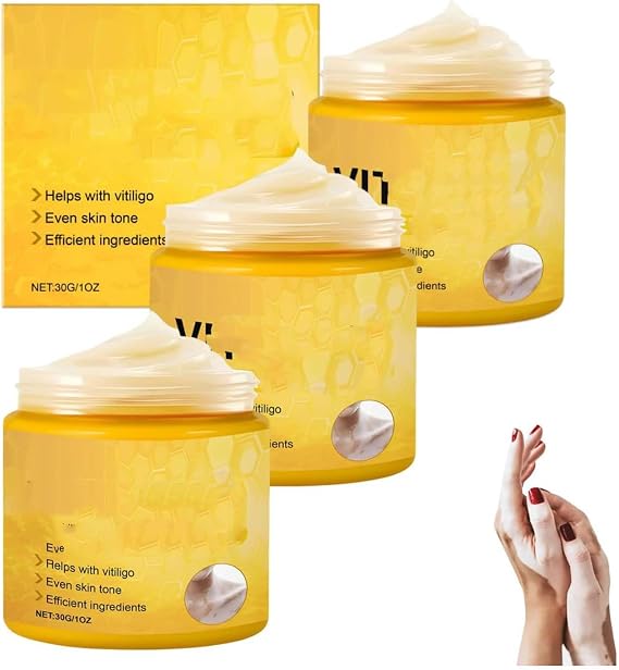 VitiClear Bee Venom Cream, Cvreoz VitiClear Pro Ultra Bee Venom Cream, Professional Vitiligo Creams,vitiligo cream,Natural Vitiligo Treatment Cr-eam