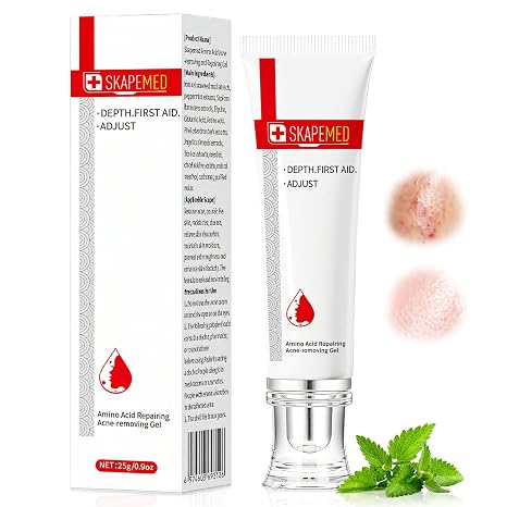 Anti Pimple Gel 25 g Face Care Acne Cream Relief of Redness Oil Control Skincare Screme Acne Gel Reduces Blemishes and Pimples Soothes the Skin Gentle Effective