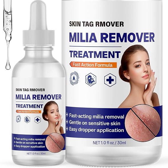 Milia Remover Serum for Face, Targets Milia Around Eyes, Nose & Cheeks, Gentle Formula with Salicylic Acid for Sensitive Skin, 3 oz